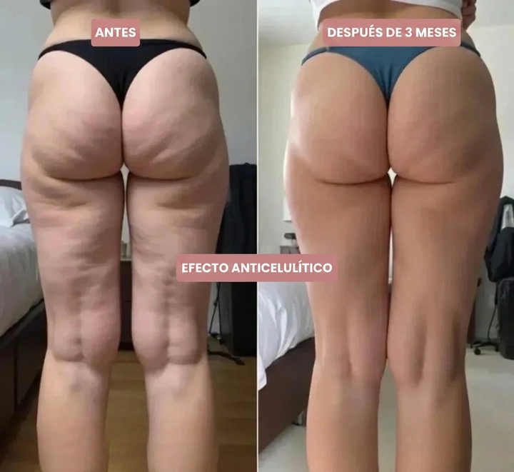 Curvella 3D Legging – Redefine tu silueta sin esfuerzo